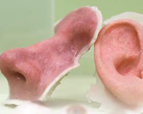 3D yazıcı ile burun nakil